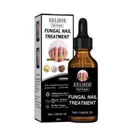 EELHOE Nail Repair Solution Thickening And Shining Nail Removal Dead Skin Repairing And Moisturizing Nail Nutritional Care Liquid (muscle supportOption: 1pcs)